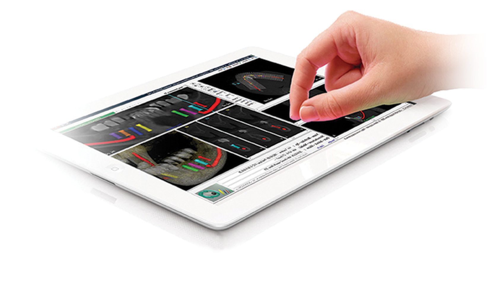 tabletkicsi